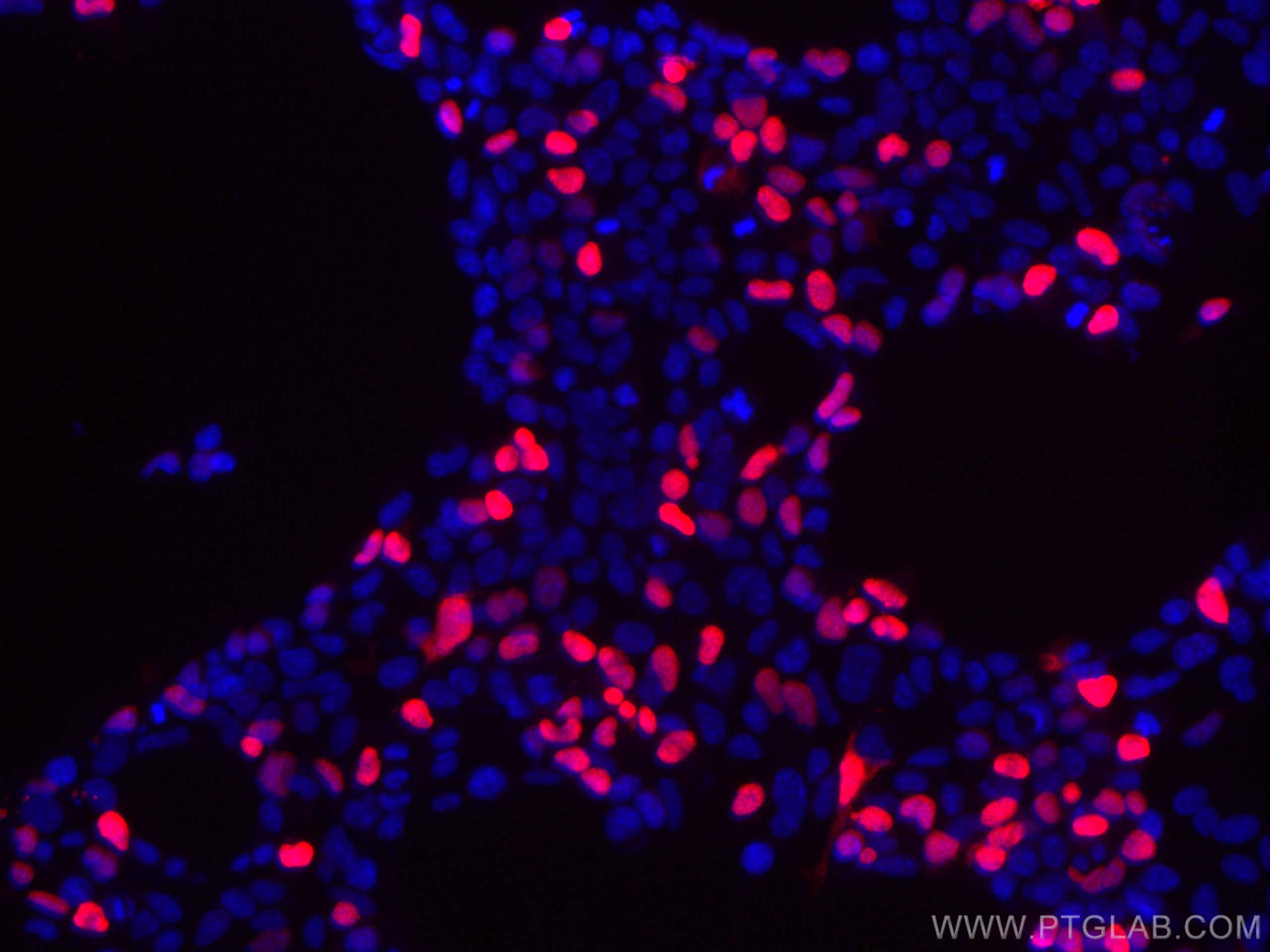 IF Staining of Transfected HEK-293 using CL594-80010