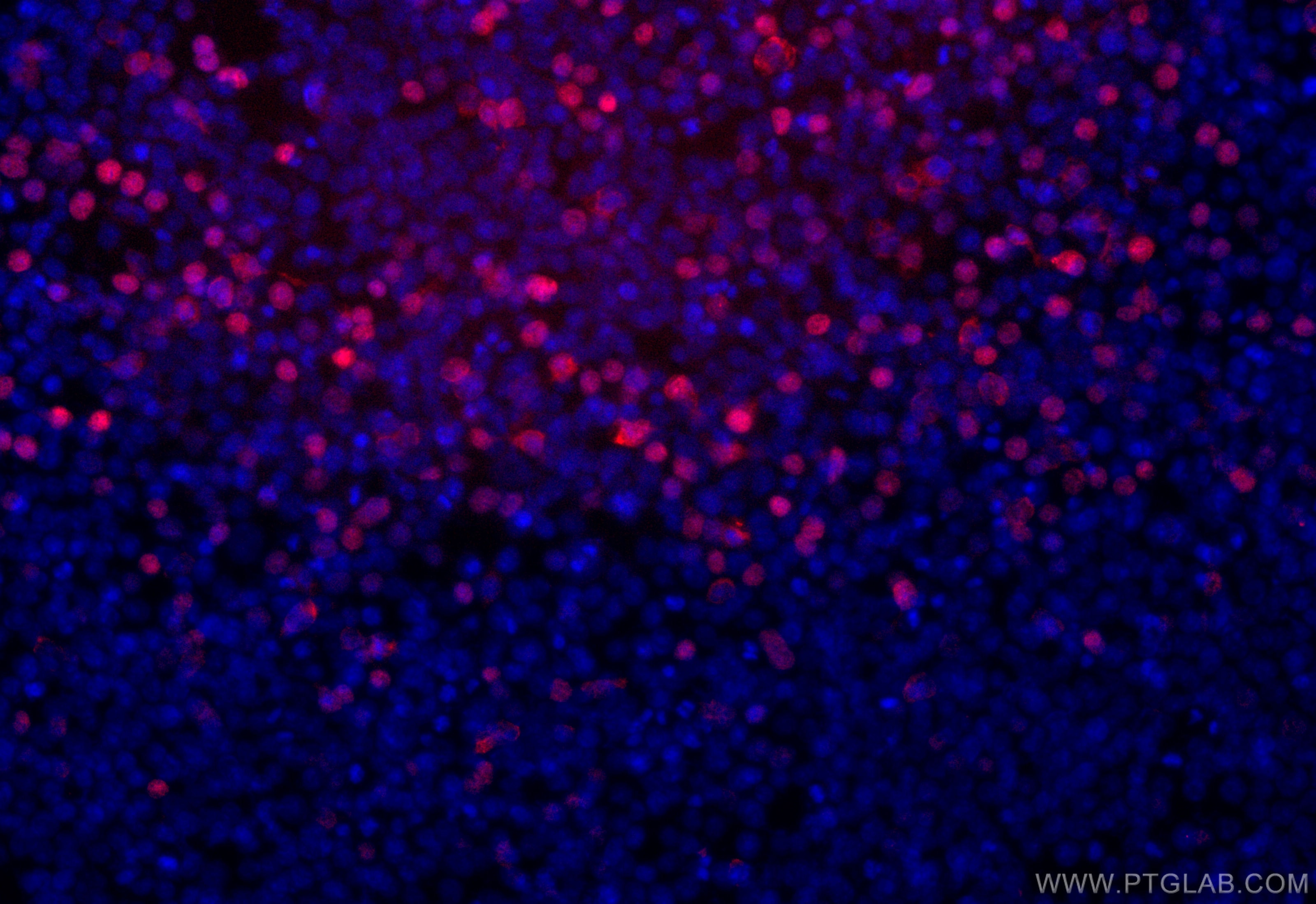 Immunofluorescence (IF) / fluorescent staining of Transfected HEK-293 cells using CoraLite®594-conjugated DYKDDDDK tag Recombinant a (CL594-80801-2)