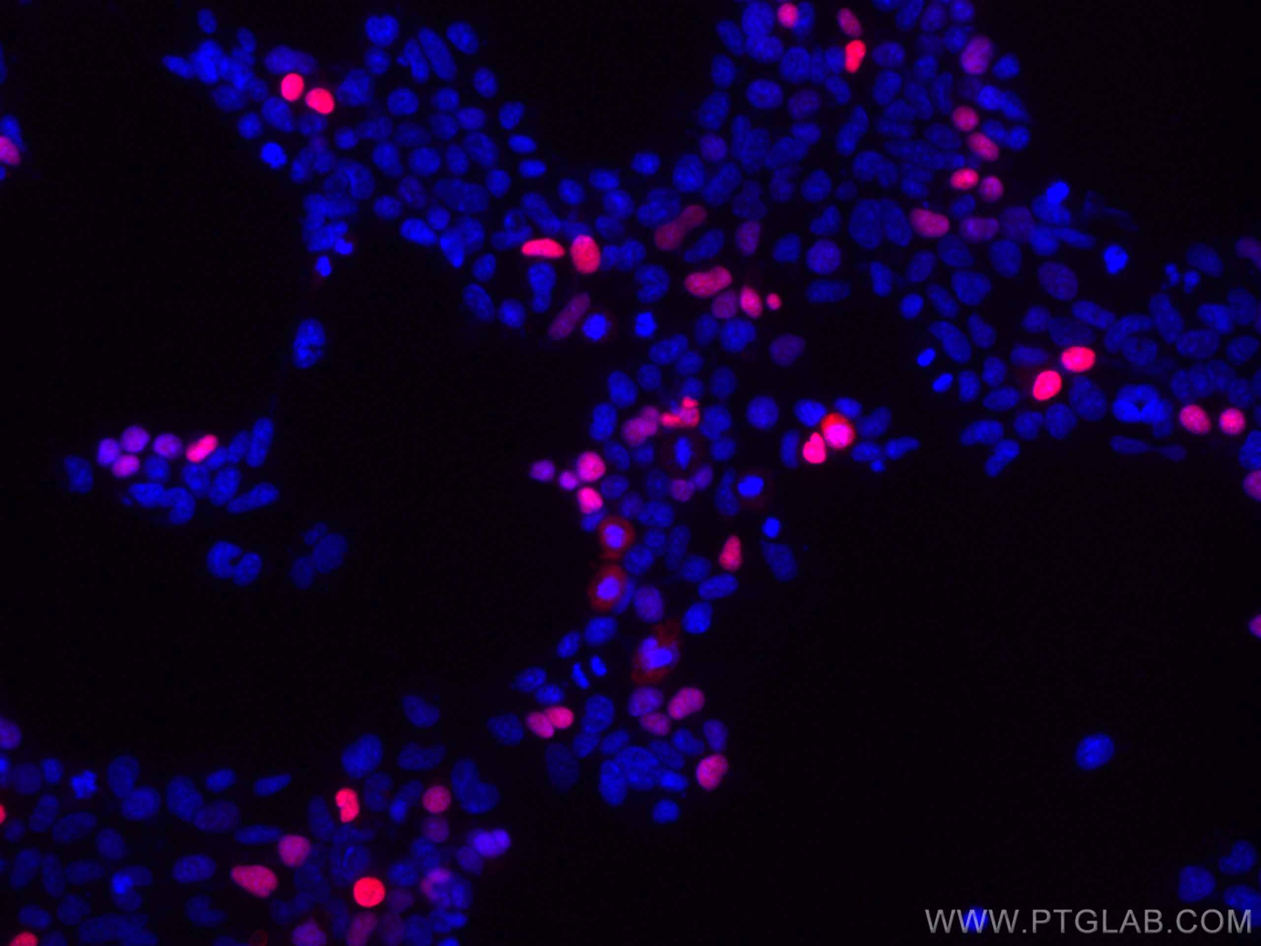 Immunofluorescence (IF) / fluorescent staining of Transfected HEK-293 cells using CoraLite® Plus 647-conjugated DYKDDDDK tag Recombi (CL647-80010)