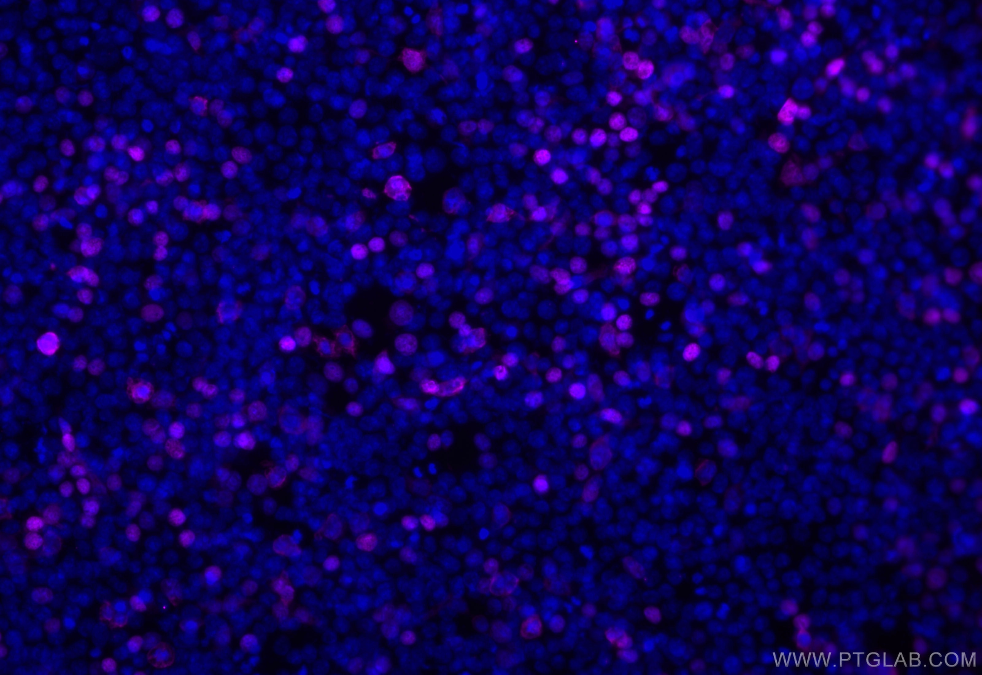 Immunofluorescence (IF) / fluorescent staining of Transfected HEK-293 cells using CoraLite® Plus 647-conjugated DYKDDDDK tag Recombi (CL647-80801-2)