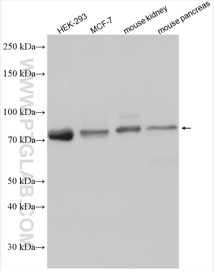 Western Blot (WB) analysis of various lysates using Dymeclin Polyclonal antibody (12001-1-AP)