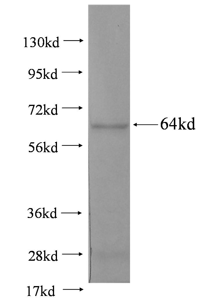 DYM fusion protein Ag2600 SDS-PAGE