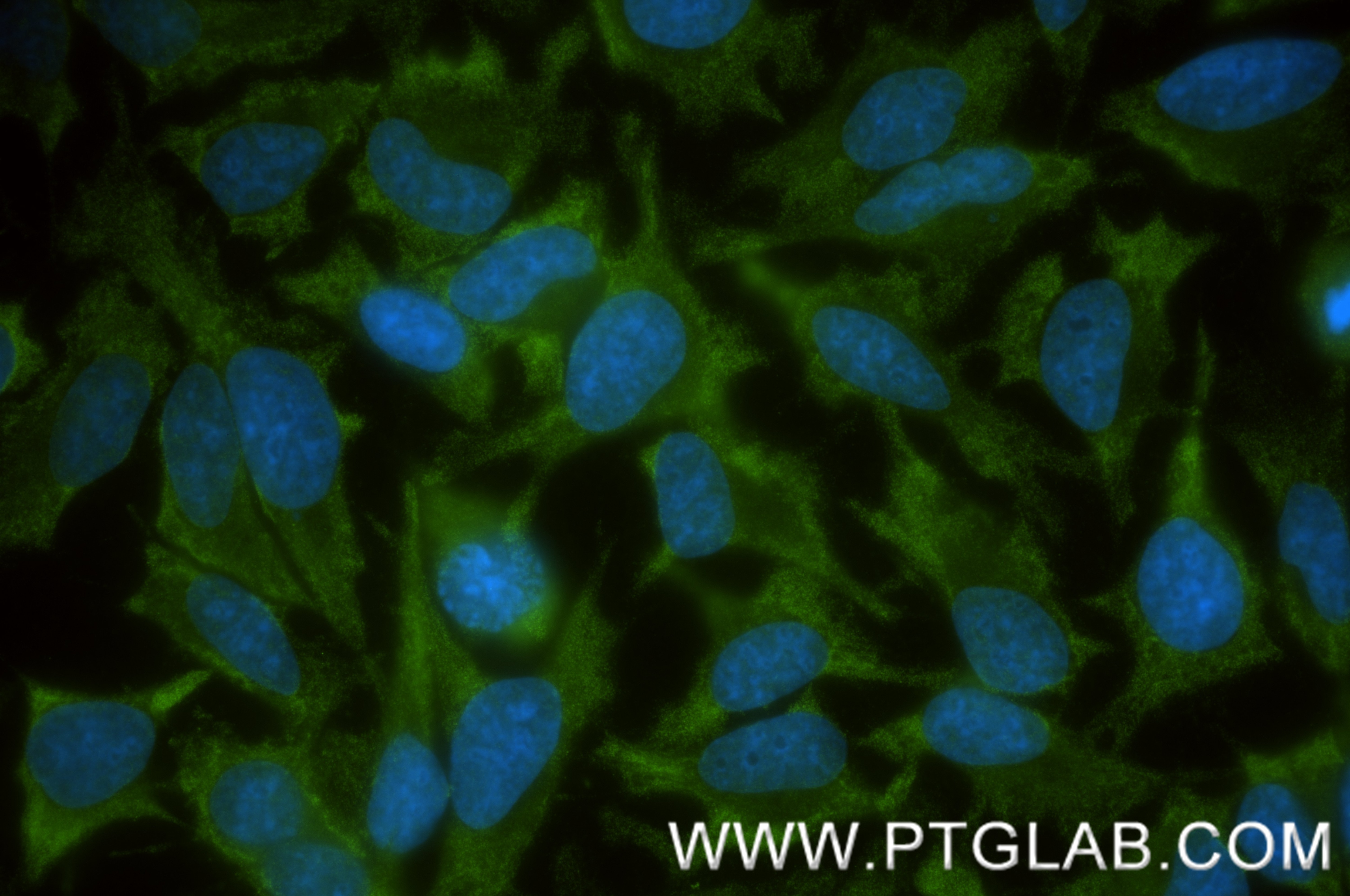 Immunofluorescence (IF) / fluorescent staining of HeLa cells using DYNC1H1 Recombinant monoclonal antibody (85397-4-RR)