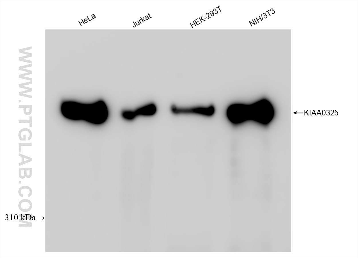 DYNC1H1