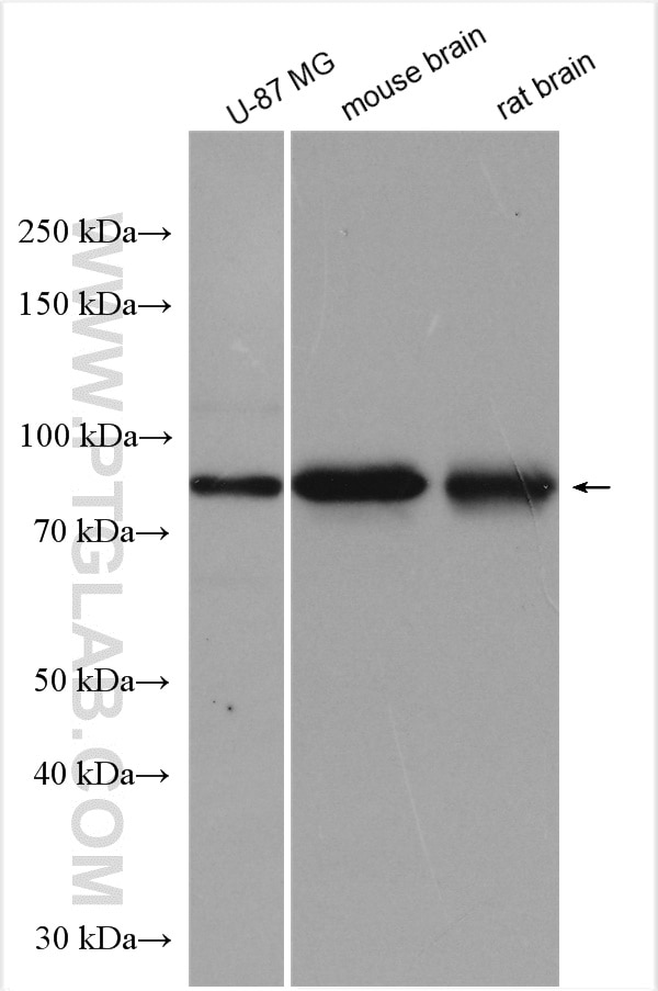 Western Blot (WB) analysis of various lysates using DYNC1I1 Polyclonal antibody (13808-1-AP)