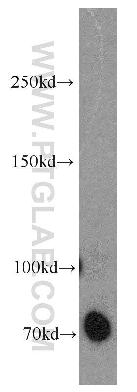 DYNC1I1 Polyclonal antibody