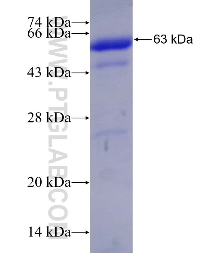 DYNC1I1 fusion protein Ag4810 SDS-PAGE
