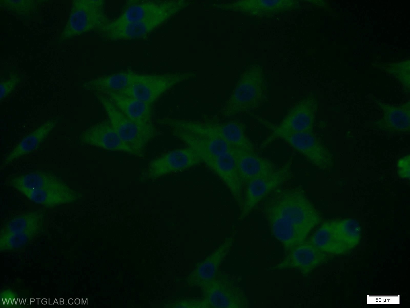 DYNC1I2 Polyclonal antibody