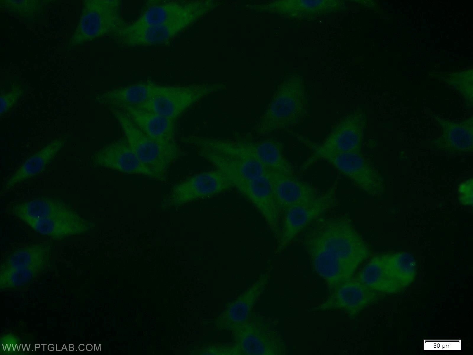 Immunofluorescence (IF) / fluorescent staining of A375 cells using DYNC1I2 Polyclonal antibody (12219-1-AP)