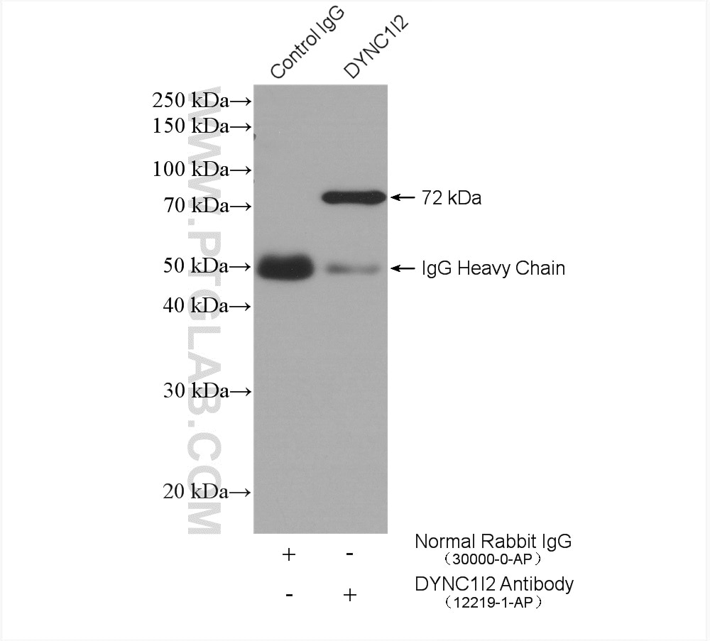 Immunoprecipitation (IP) experiment of HeLa cells using DYNC1I2 Polyclonal antibody (12219-1-AP)