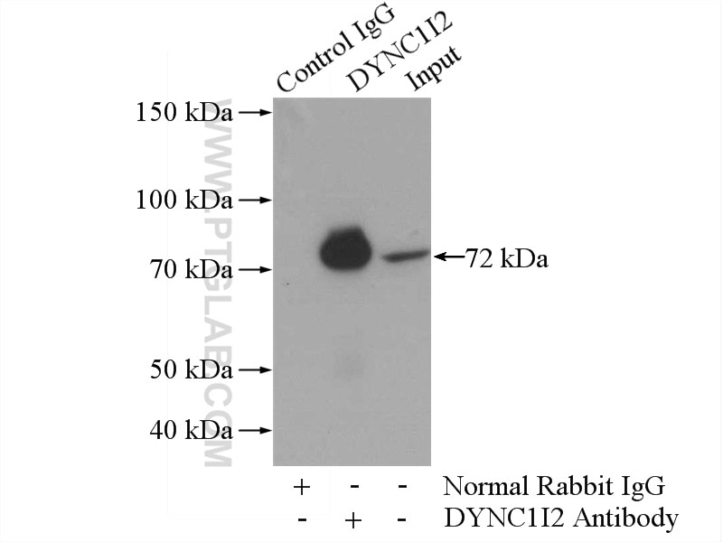 Immunoprecipitation (IP) experiment of mouse testis tissue using DYNC1I2 Polyclonal antibody (12219-1-AP)