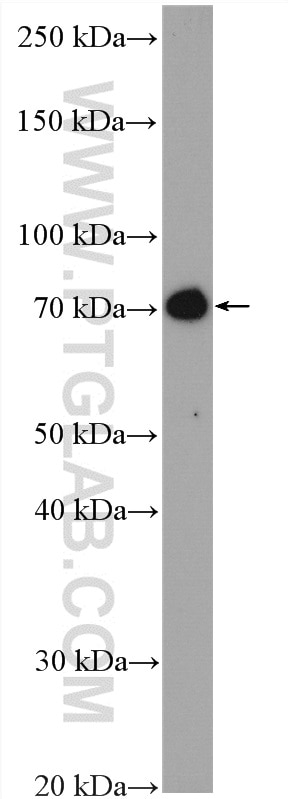 Western Blot (WB) analysis of Jurkat cells using DYNC1I2 Polyclonal antibody (12219-1-AP)