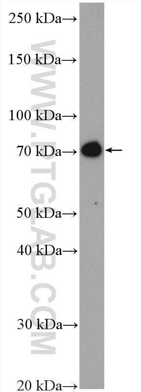 WB analysis of Jurkat using 12219-1-AP