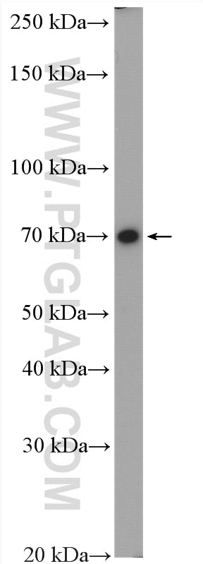Western Blot (WB) analysis of A375 cells using DYNC1I2 Polyclonal antibody (12219-1-AP)