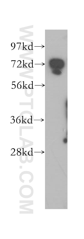 Western Blot (WB) analysis of human brain tissue using DYNC1I2 Polyclonal antibody (12219-1-AP)