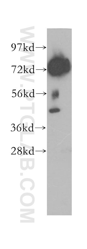 Western Blot (WB) analysis of mouse testis tissue using DYNC1I2 Polyclonal antibody (12219-1-AP)