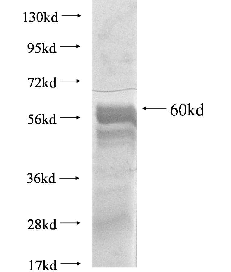 DYNC1I2 fusion protein Ag2873 SDS-PAGE