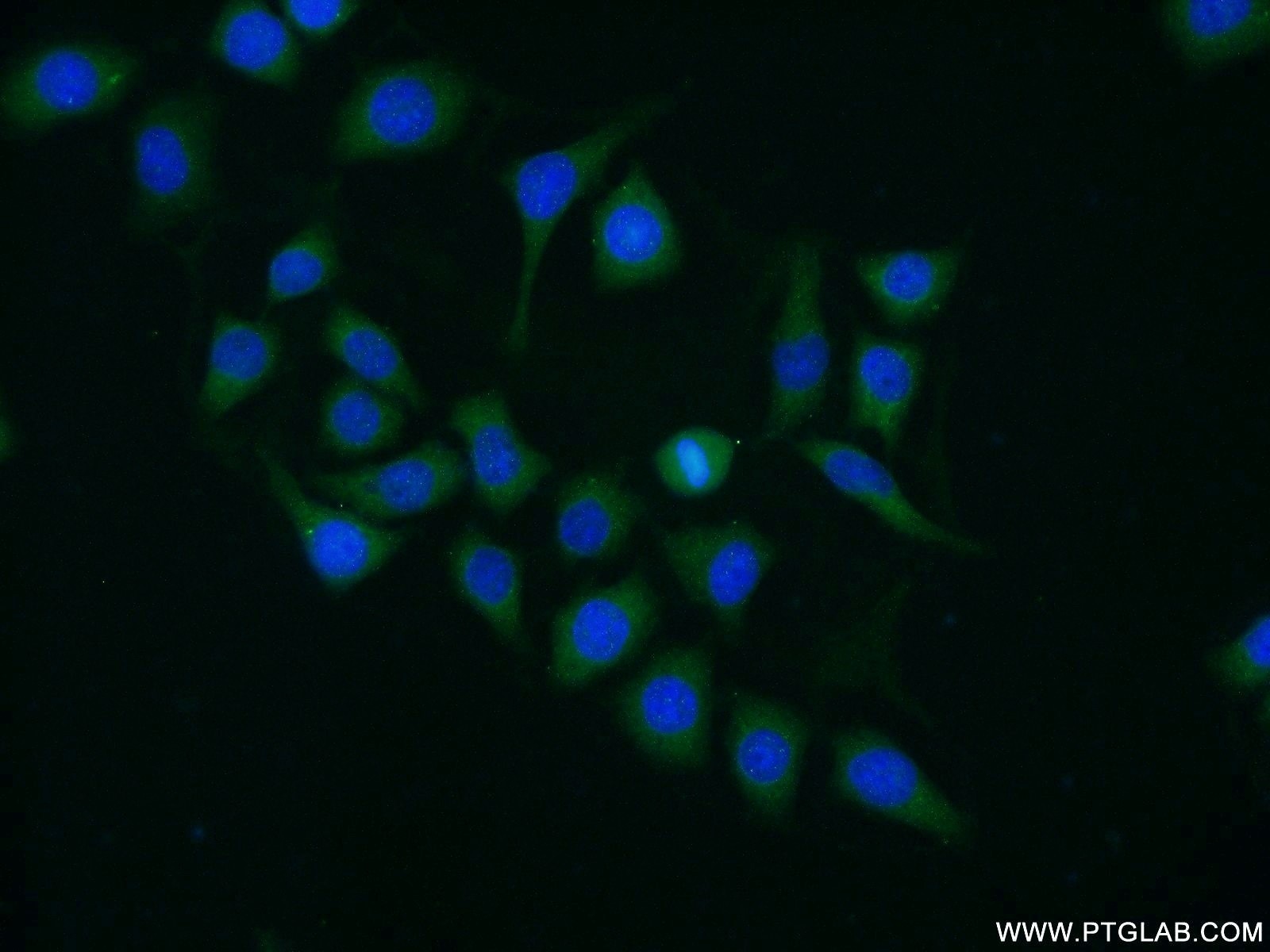 Immunofluorescence (IF) / fluorescent staining of HeLa cells using DYNC1LI1 Polyclonal antibody (25326-1-AP)
