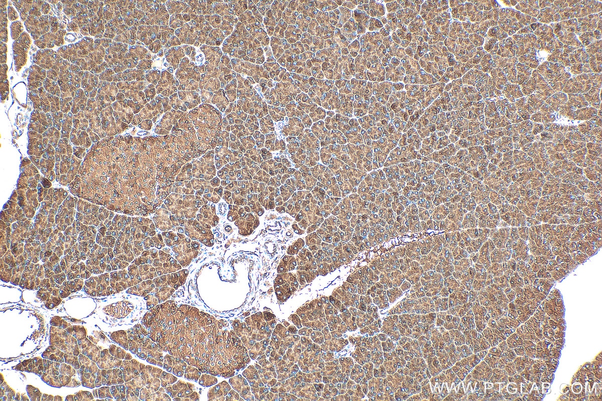 Immunohistochemistry (IHC) staining of mouse pancreas tissue using DYNC1LI1 Polyclonal antibody (25326-1-AP)