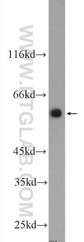 Western Blot (WB) analysis of K-562 cells using DYNC1LI1 Polyclonal antibody (25326-1-AP)