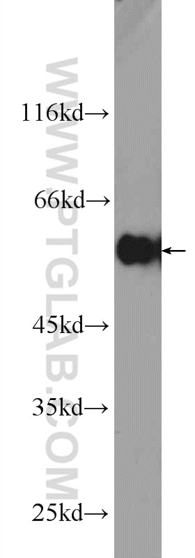 Western Blot (WB) analysis of HeLa cells using DYNC1LI1 Polyclonal antibody (25326-1-AP)