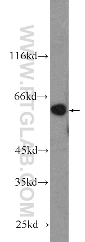 Western Blot (WB) analysis of Jurkat cells using DYNC1LI1 Polyclonal antibody (25326-1-AP)