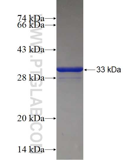 DYNC1LI1 fusion protein Ag18191 SDS-PAGE