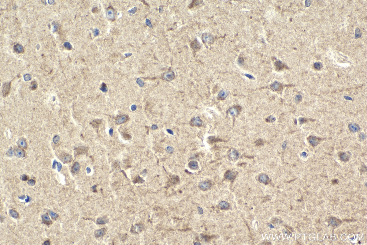 Immunohistochemistry (IHC) staining of mouse brain tissue using DYNC1LI2 Polyclonal antibody (18885-1-AP)