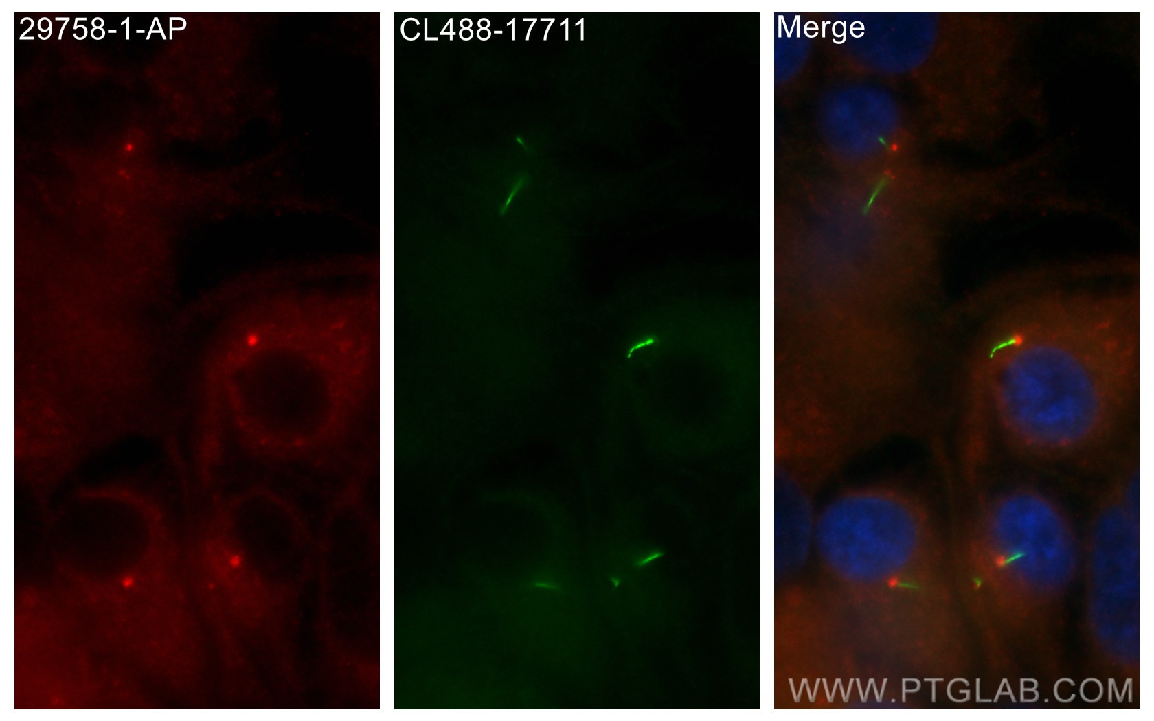 Immunofluorescence (IF) / fluorescent staining of hTERT-RPE1 cells using DYNC2H1 Polyclonal antibody (29758-1-AP)