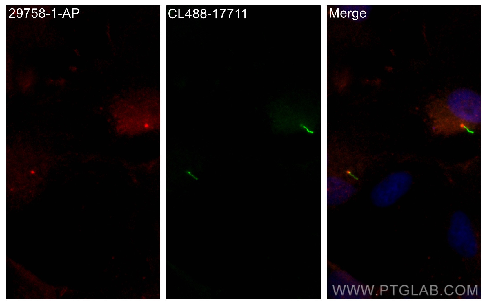 Immunofluorescence (IF) / fluorescent staining of hTERT-RPE1 cells using DYNC2H1 Polyclonal antibody (29758-1-AP)