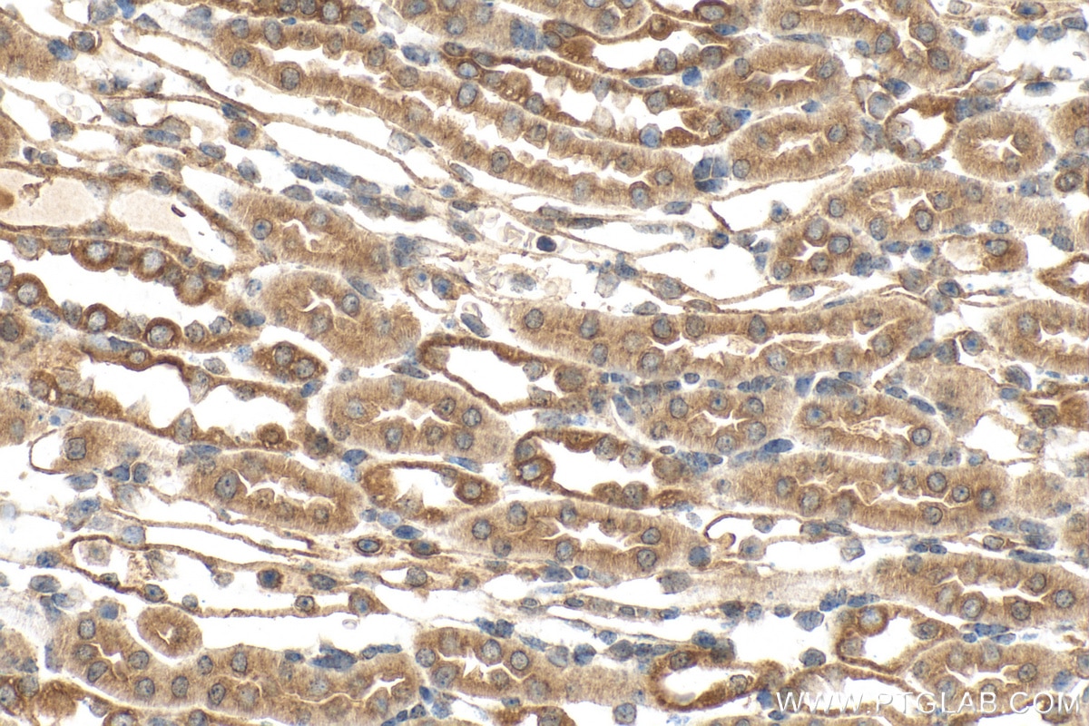 Immunohistochemistry (IHC) staining of mouse kidney tissue using DYNC2H1 Polyclonal antibody (29758-1-AP)