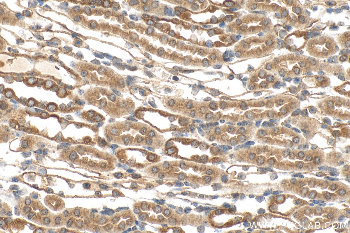 IHC staining of mouse kidney using 29758-1-AP