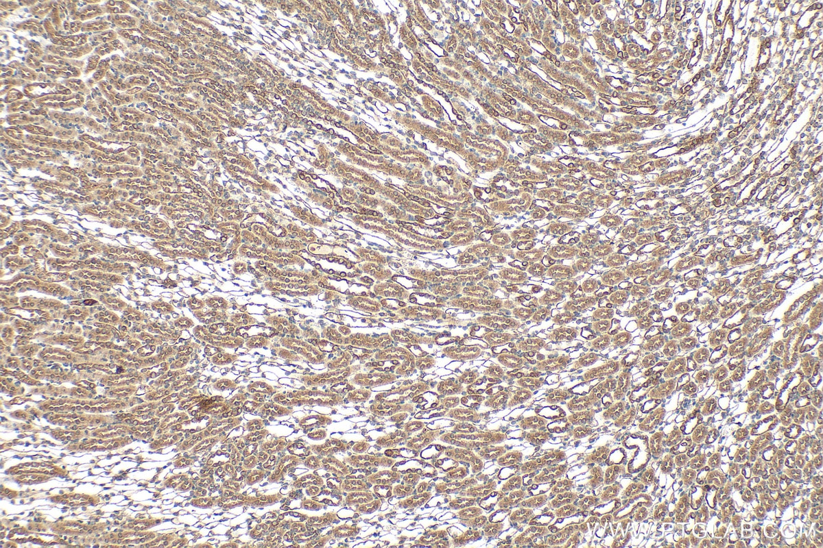 Immunohistochemistry (IHC) staining of mouse kidney tissue using DYNC2H1 Polyclonal antibody (29758-1-AP)