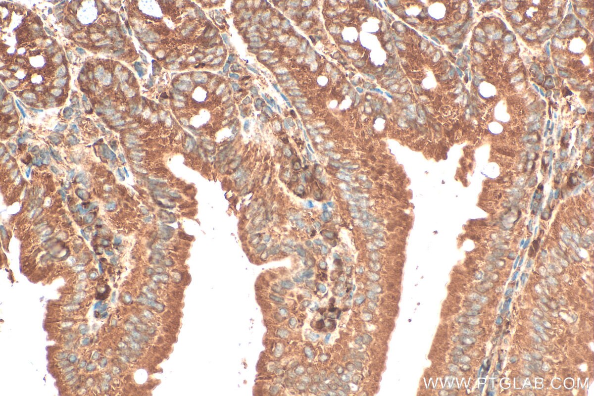 Immunohistochemistry (IHC) staining of mouse small intestine tissue using DYNC2H1 Polyclonal antibody (29758-1-AP)