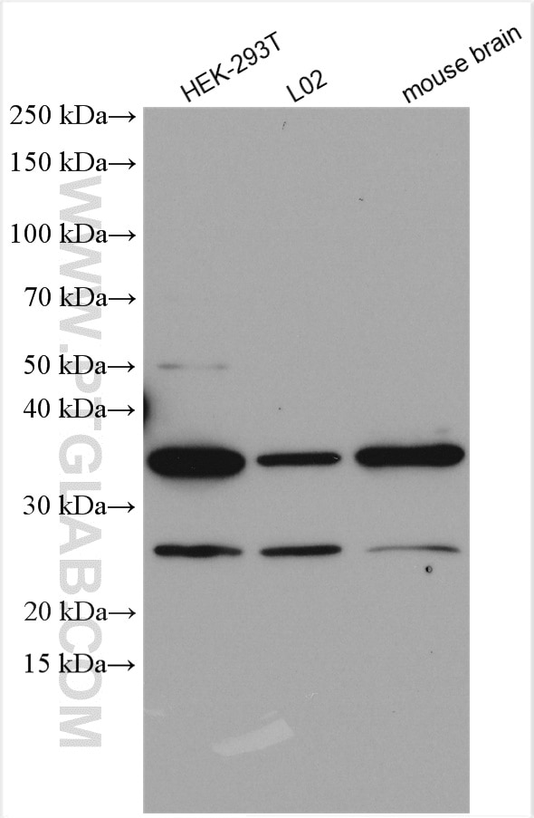 Western Blot (WB) analysis of various lysates using DYNC2LI1 Polyclonal antibody (15949-1-AP)