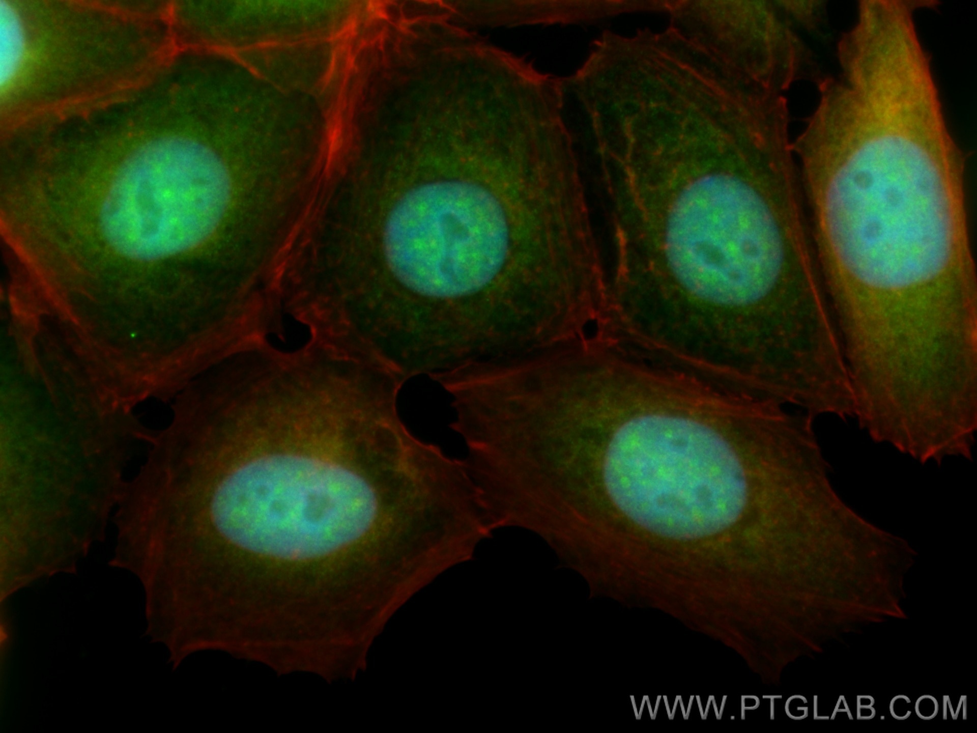 Immunofluorescence (IF) / fluorescent staining of MCF-7 cells using LC8/DYNLL1 Polyclonal antibody (18130-1-AP)