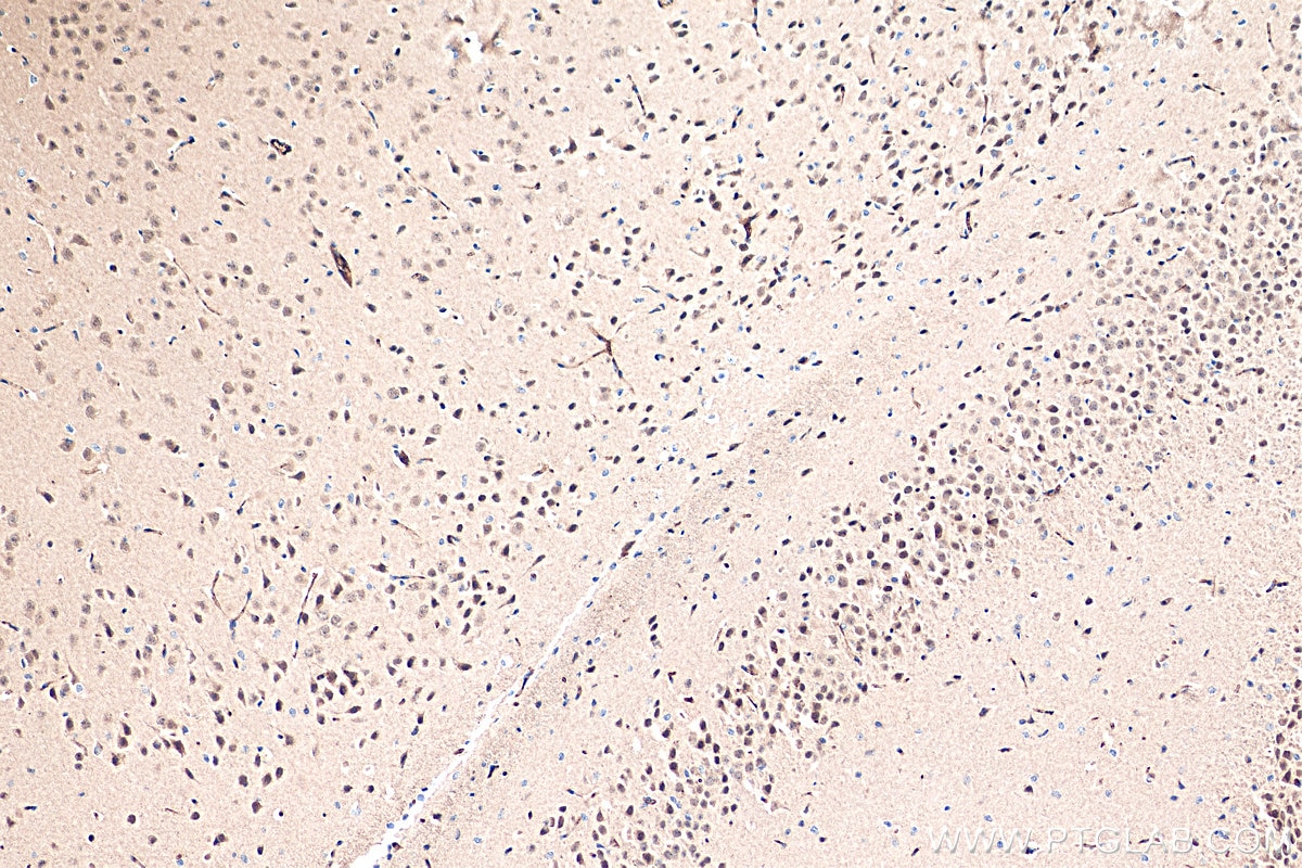 Immunohistochemistry (IHC) staining of mouse brain tissue using LC8/DYNLL1 Polyclonal antibody (18130-1-AP)