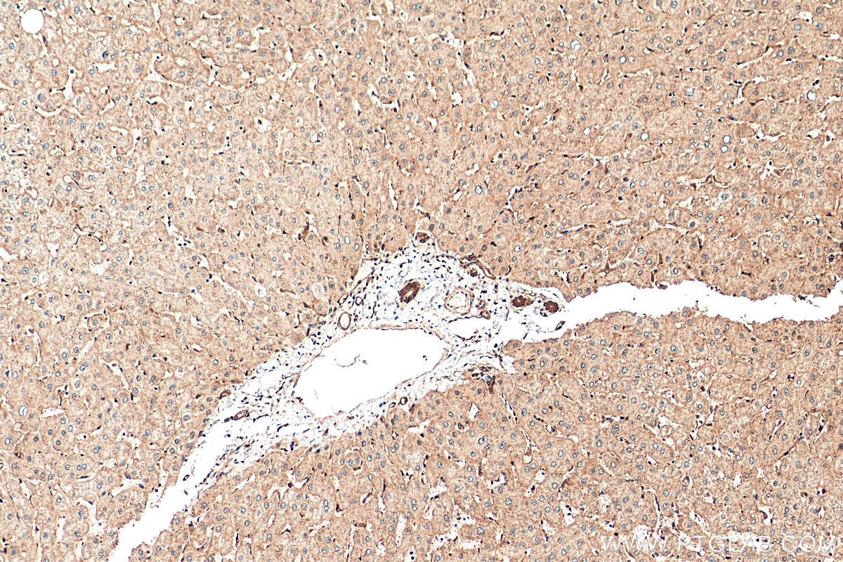 Immunohistochemistry (IHC) staining of human liver tissue using LC8/DYNLL1 Polyclonal antibody (18130-1-AP)