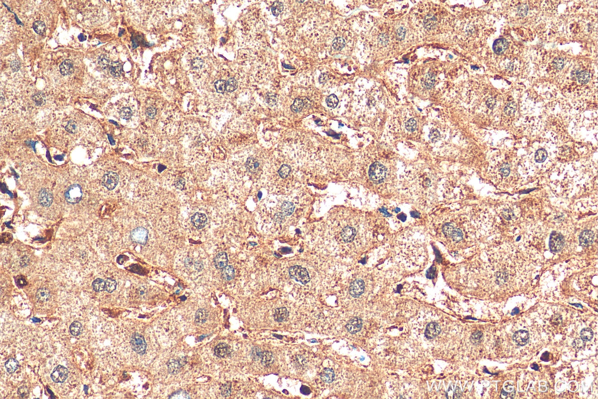 Immunohistochemistry (IHC) staining of human liver tissue using LC8/DYNLL1 Polyclonal antibody (18130-1-AP)