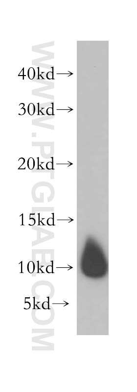 Western Blot (WB) analysis of human heart tissue using DYNLL2 Polyclonal antibody (16811-1-AP)