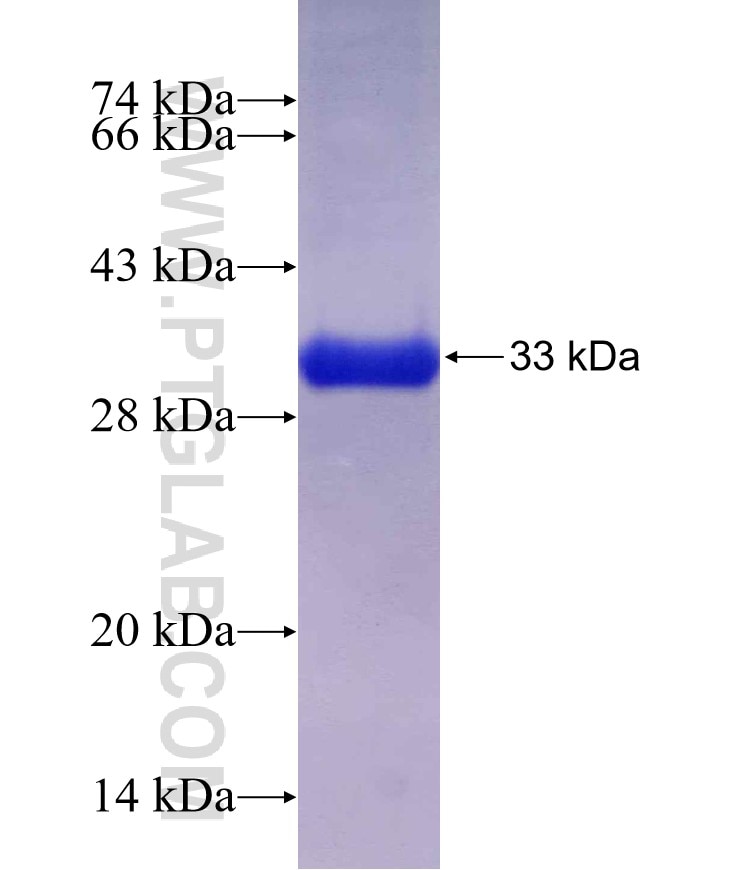 DYNLRB1 fusion protein Ag7032 SDS-PAGE