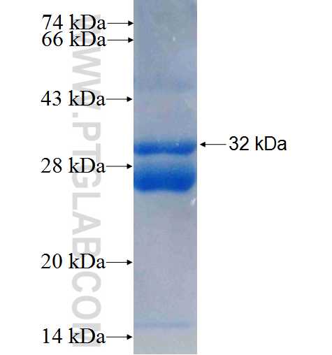 DYNLRB2 fusion protein Ag9842 SDS-PAGE