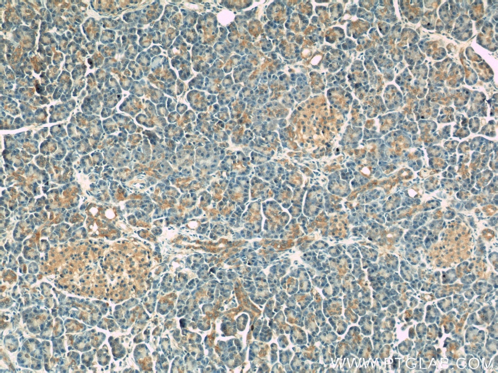 Immunohistochemistry (IHC) staining of human pancreas tissue using DYNLT1 Polyclonal antibody (11954-1-AP)