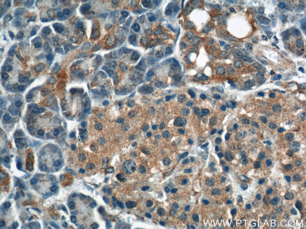 Immunohistochemistry (IHC) staining of human pancreas tissue using DYNLT1 Polyclonal antibody (11954-1-AP)