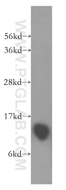 Western Blot (WB) analysis of human brain tissue using DYNLT1 Polyclonal antibody (11954-1-AP)