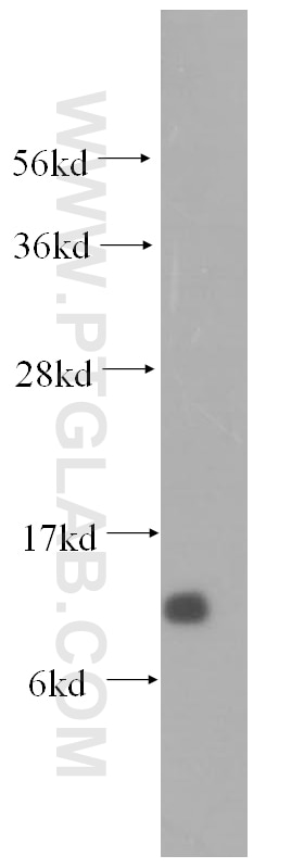 Western Blot (WB) analysis of human heart tissue using DYNLT1 Polyclonal antibody (11954-1-AP)