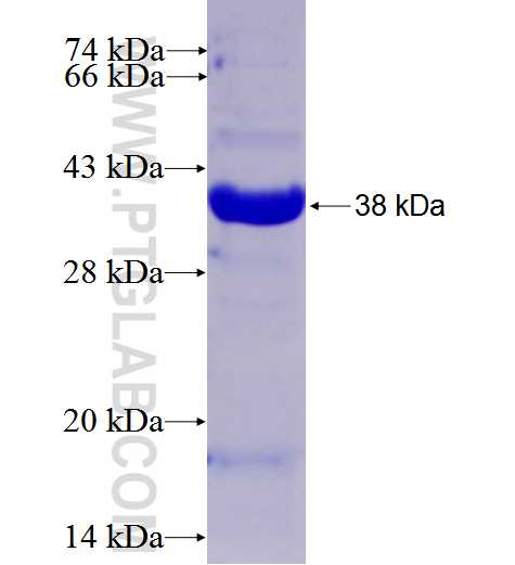 DYNLT1 fusion protein Ag2557 SDS-PAGE