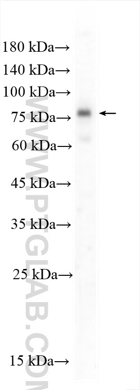 Western Blot (WB) analysis of HEK-293 cells using DYRK1A Polyclonal antibody (28607-1-AP)