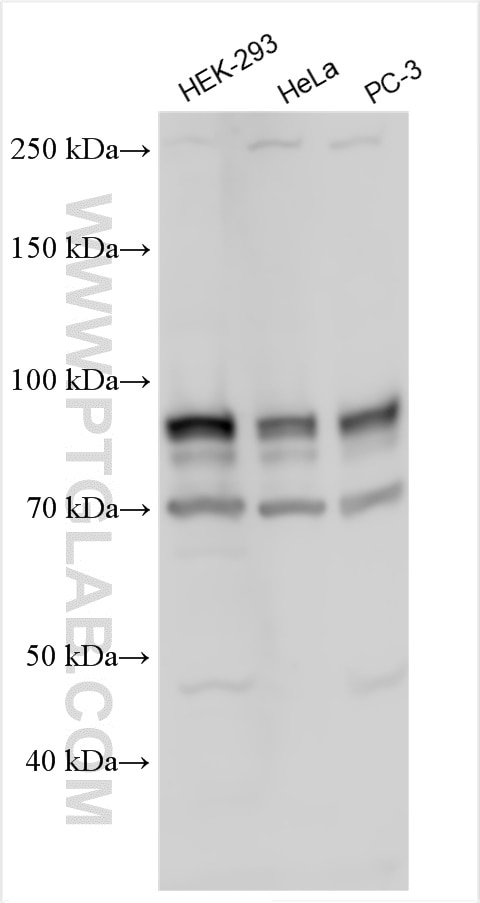 Western Blot (WB) analysis of various lysates using DYRK1A Polyclonal antibody (28607-1-AP)