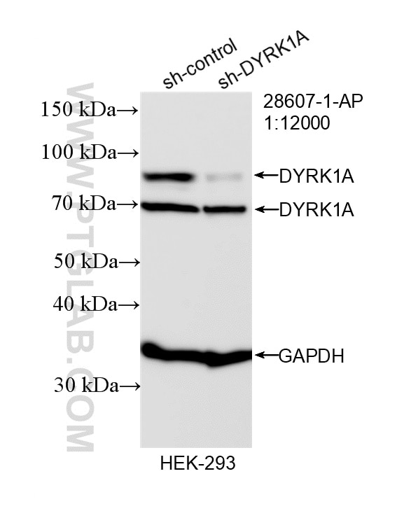 WB analysis of HEK-293 using 28607-1-AP Western Blot (WB) analysis of HEK-293 cells using DYRK1A Polyclonal antibody (28607-1-AP)